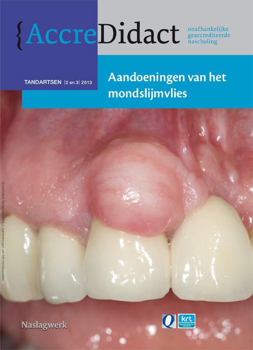Isaac van der Waal - Aandoeningen van het mondslijmvlies / AccreDidact / TA2/3-2013