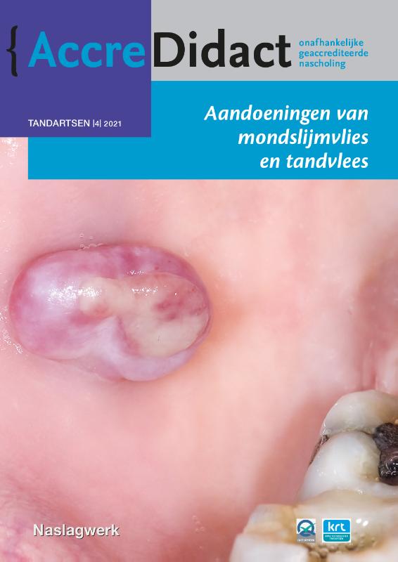 Isaäc van der Waal - Aandoeningen van mondslijmvlies en tandvlees / AccreDidact / TA2021-4
